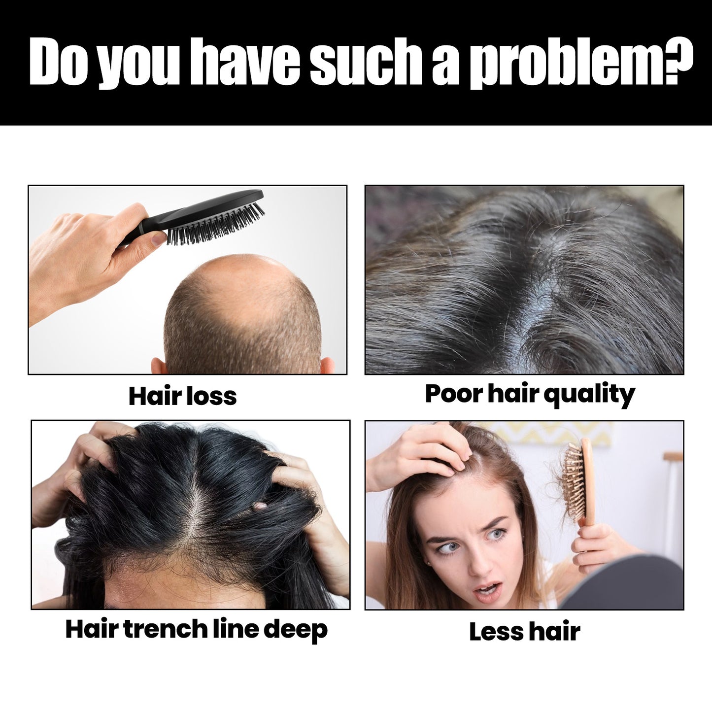 Rosemary Essential Oil For Dense Hair