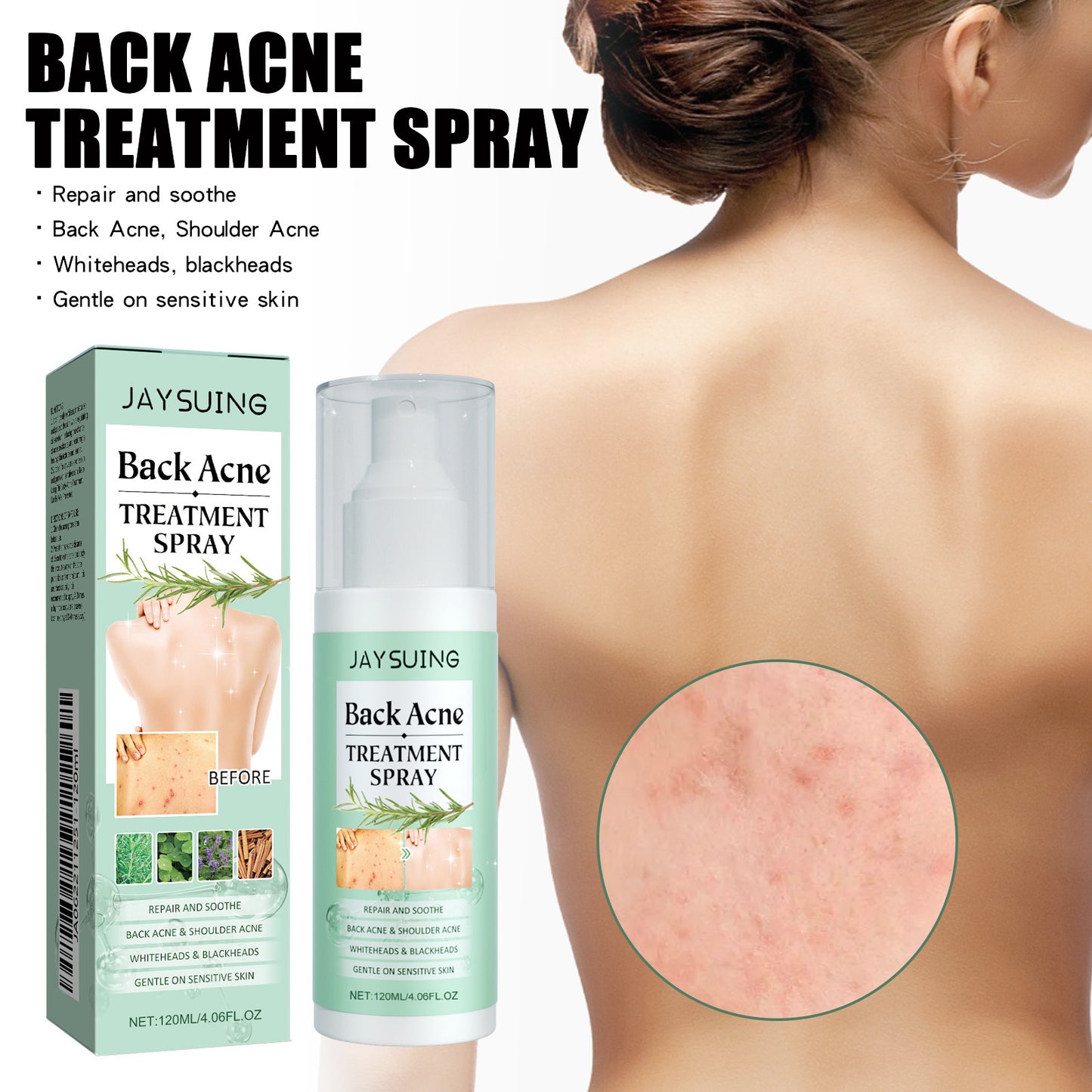 Skin Nourishing Back Care Spray