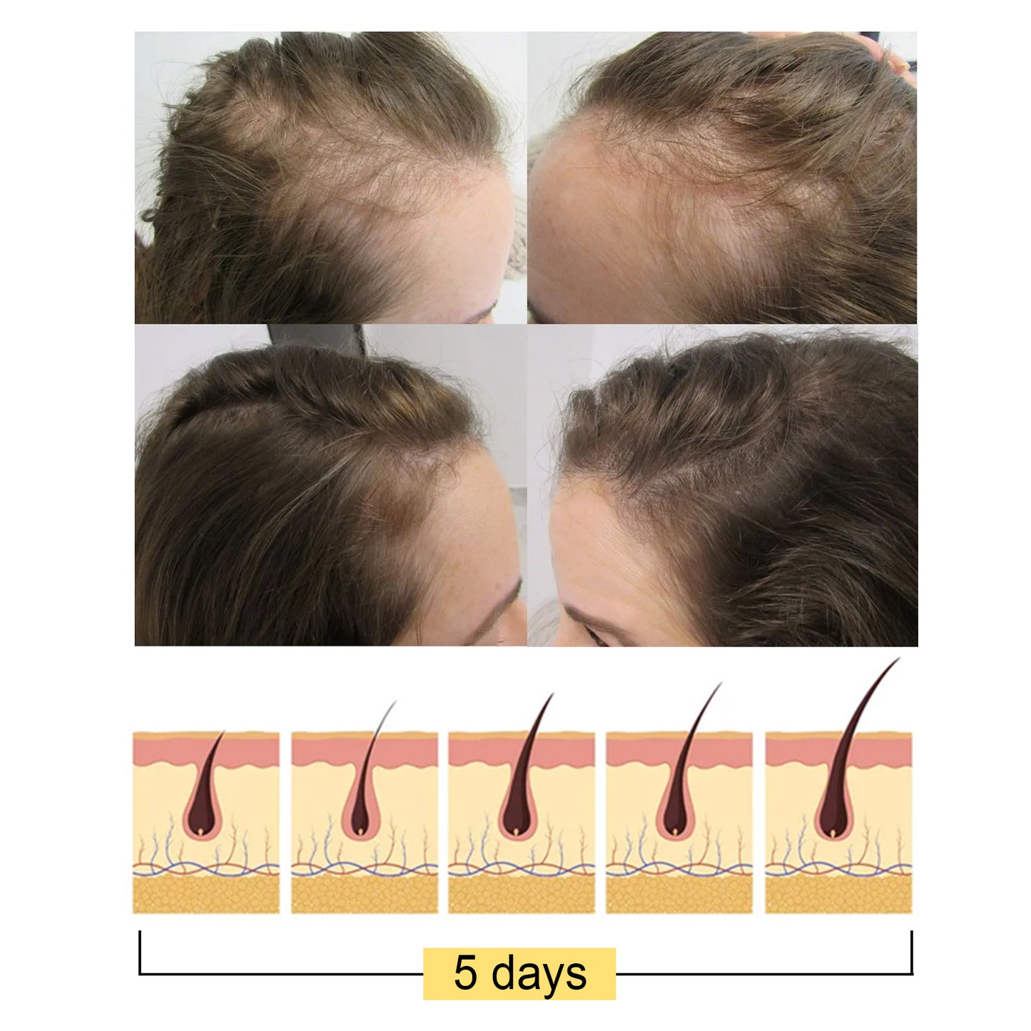 Moisturizing And Cleansing Scalp Hair Care Shampoo