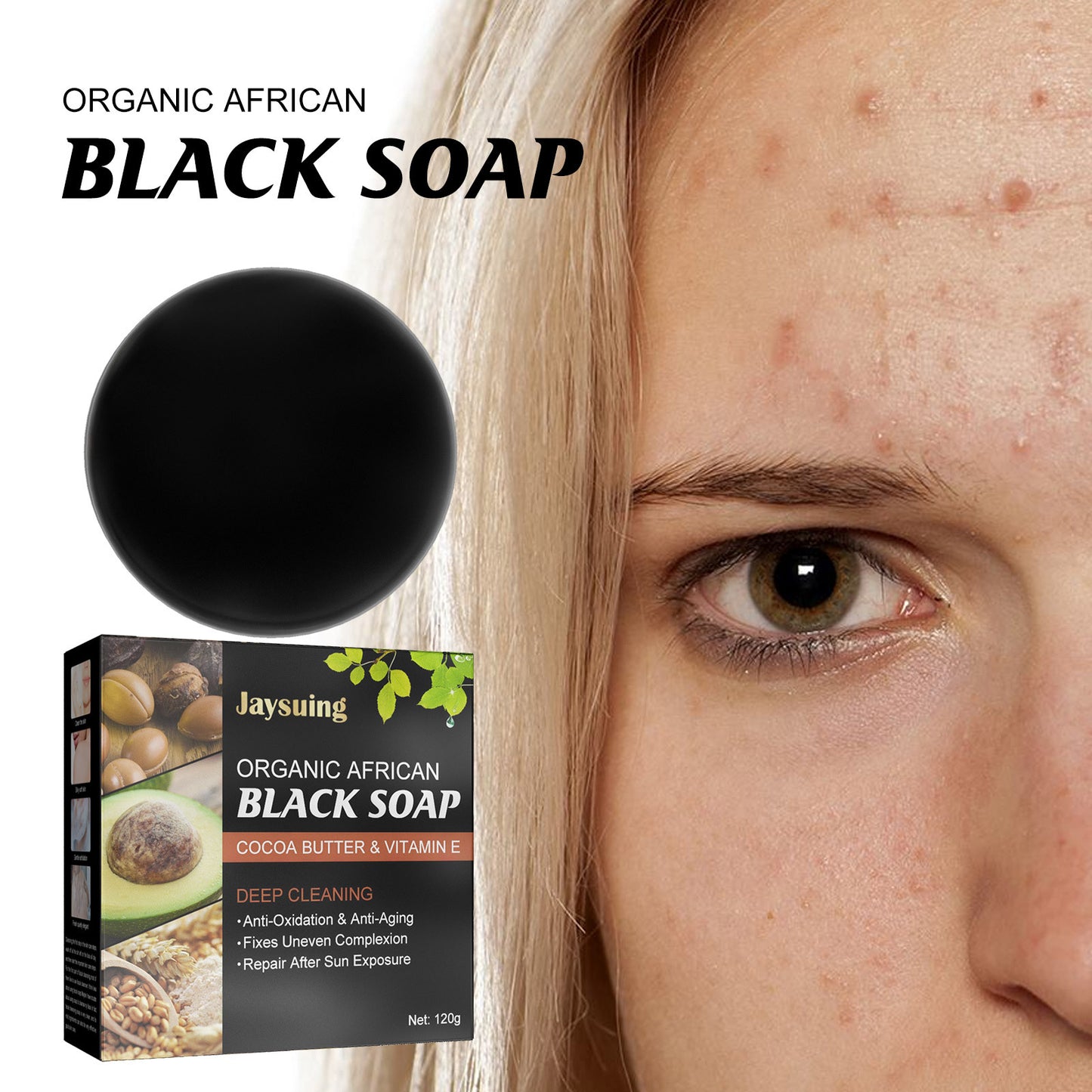 Back Acne Care Skin Bath Soap
