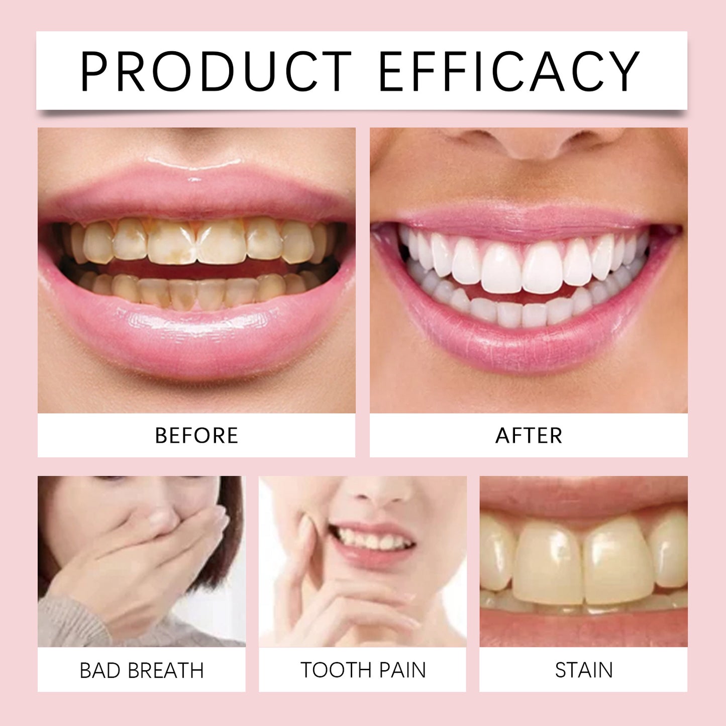 Probiotic Brightening Toothpaste For Teeth Cleaning And Hygiene, Reducing Stains, And Oral Care Toothpaste